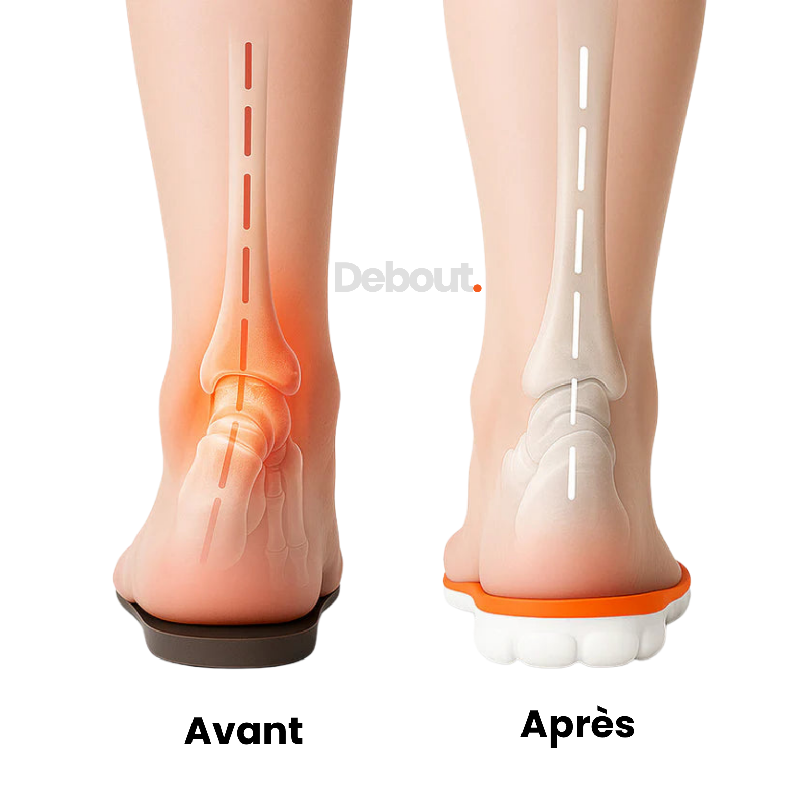 DEBOUT.  EnduraStep
